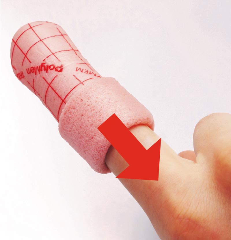 PolyMem-Finger-Anlegen-3
